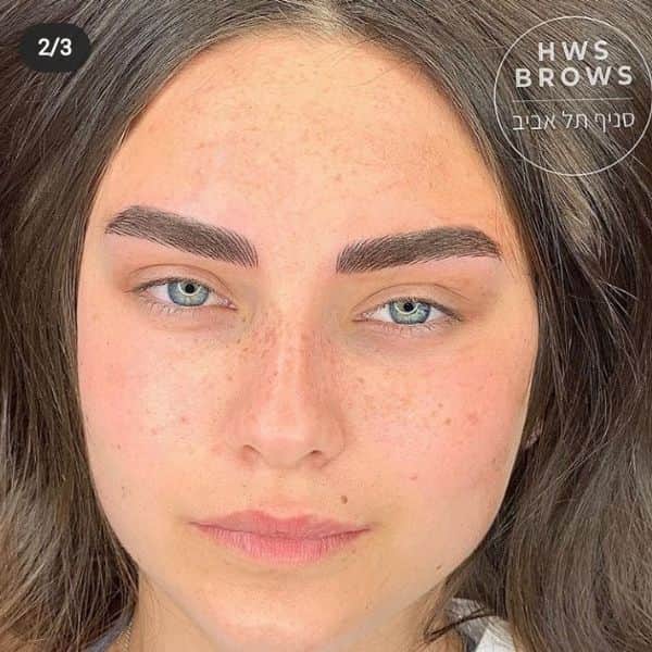 טיפול מיקרופגמנטציה